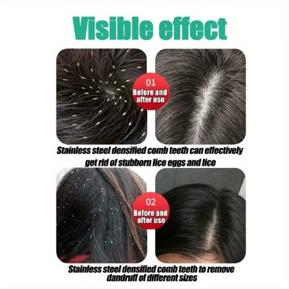 Demonstration of a stainless steel densified comb used to remove lice eggs and lice.
