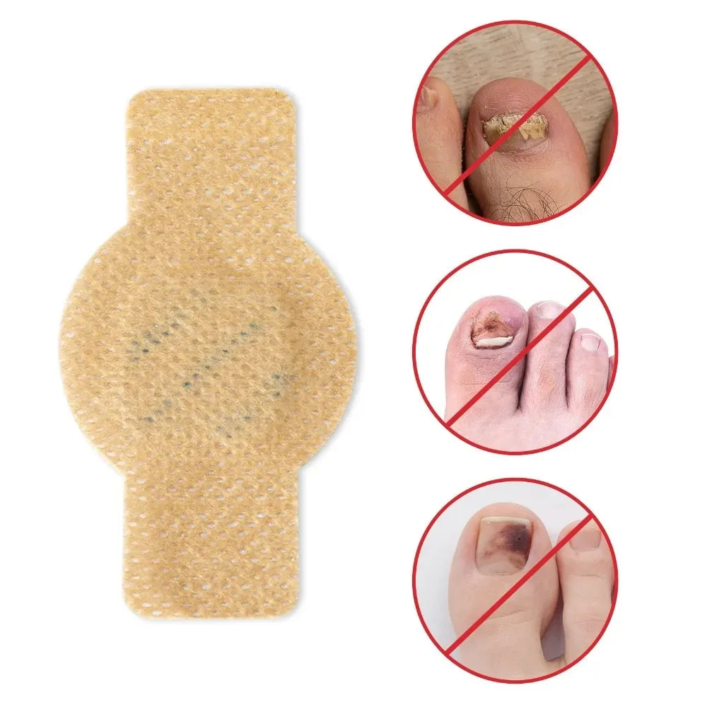 A beige waterproof nail fungus repair patch shown with three close-up images demonstrating its application.